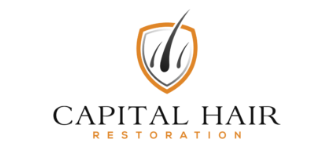 Hair Transplant Clinic Cambridgeshire